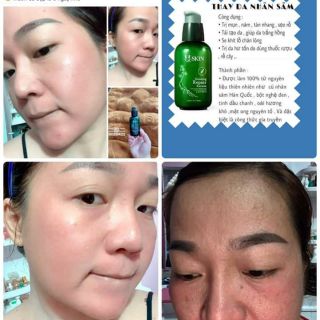 Thay da nhân sâm 500 gram