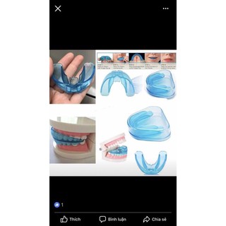 NIỀNG RĂNG SILICON BẰNG PHƯƠNG PHÁP MỚI