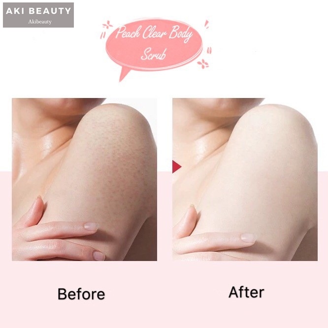 Kem Tẩy Tế Bào Chết Chiết Xuất Đào Dưỡng Ẩm Làm Trắng Da 200g