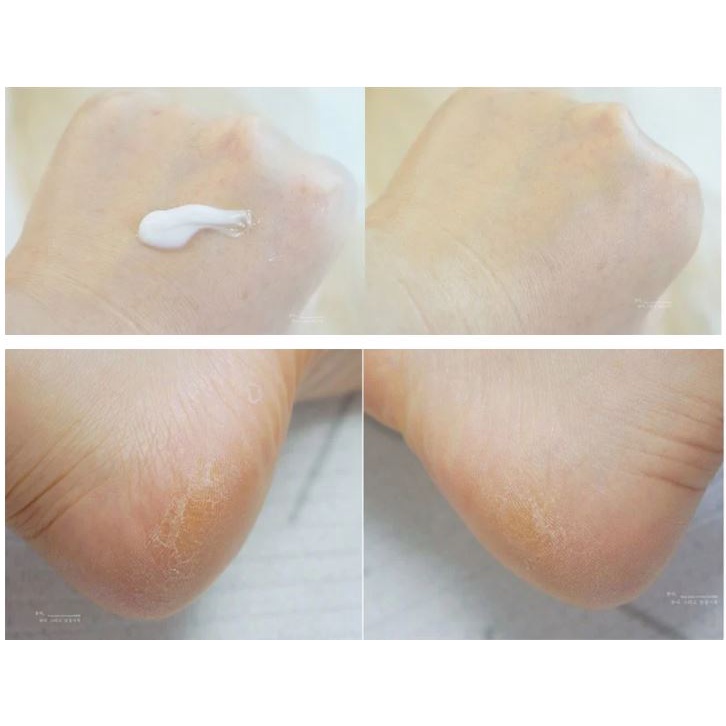 Kem Dưỡng Da Chân 3W Clinic Enrich Foot Treatment 100ml