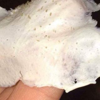 Gel hút mụn bác hà