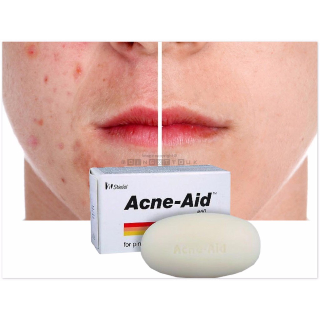 ✔️️️Xà phòng xử lý mụn, kháng khuẩn Acne - Aid Soap Bar