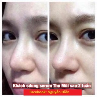 Tinh Chất Thu Nhỏ Mũi Pháp
