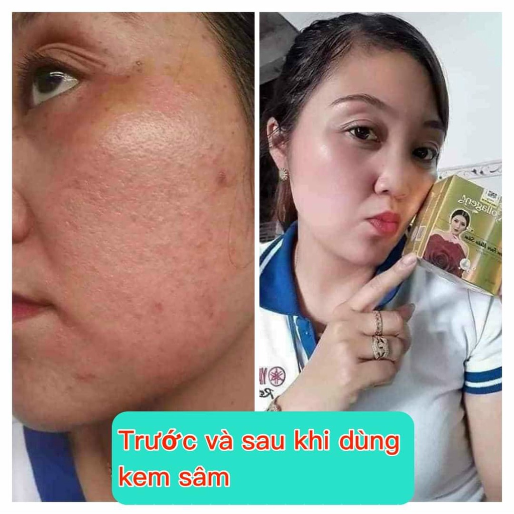 Kem dưỡng ẩm - Kem face nhân sâm dưỡng trắng da giảm nám tàn nhang Ncollagen 25g