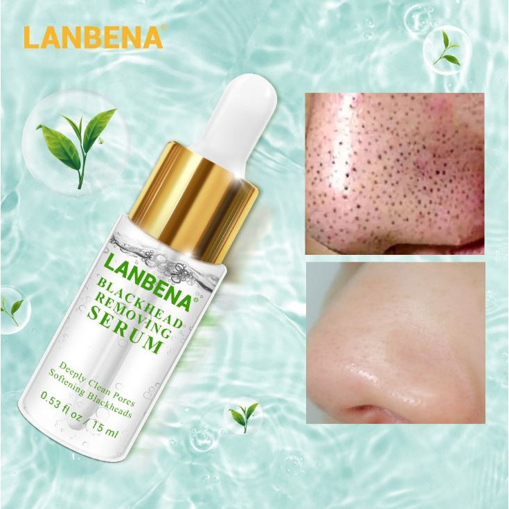 Tinh chất loại bỏ mụn đầu đen - se khít lỗ chân lông Lanbena BlackHead Removing Serum VG