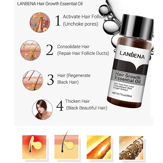 Tinh Dầu Kích Thích Mọc Tóc  20ml LANBENA