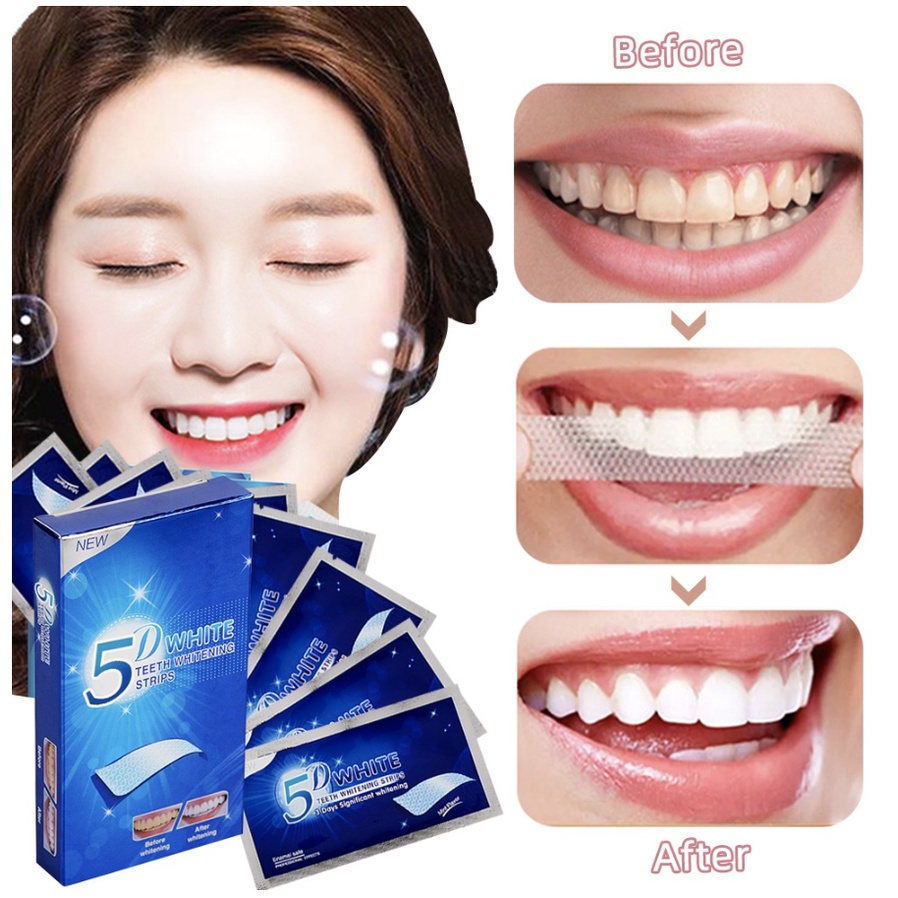 Miếng Dán Trắng Răng 3D - 5D White An Toàn, Hiệu Quả chỉ sau 7-14 ngày