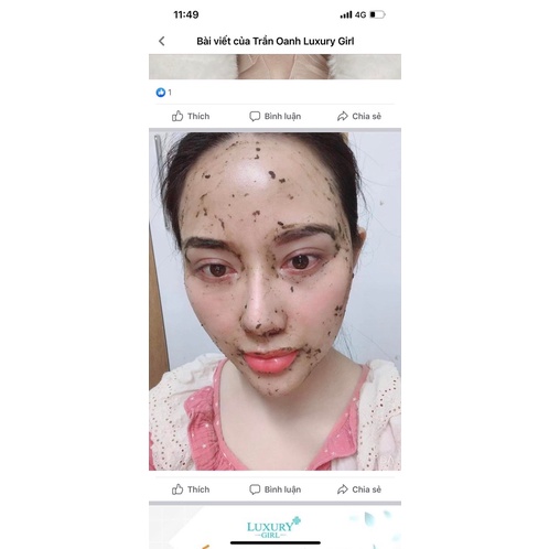 PEEL VI TẢO LỌ 10ml