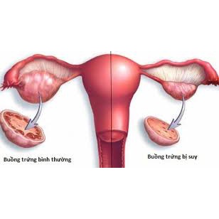 Viên uống bổ trứng Femifortil dành cho phụ nữ 60 viên