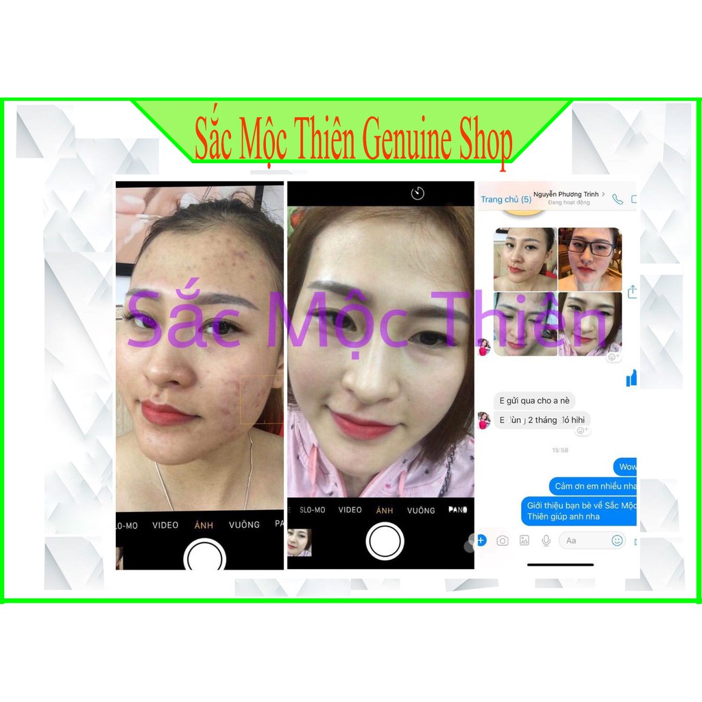 Tái Tạo Sắc Mộc Thiên -Làm bay  mụn , nám , tàn nhang- Cam kết hoàn tiền 100% nếu không hiệu quả . | BigBuy360 - bigbuy360.vn