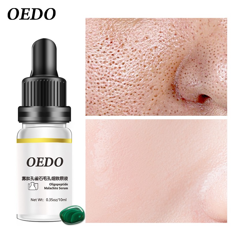 Serum OEDO Oligopeptide Malachite giảm vết nhăn chống lão hóa làm trắng da se khít lỗ chân lông dạng lỏng da mặt