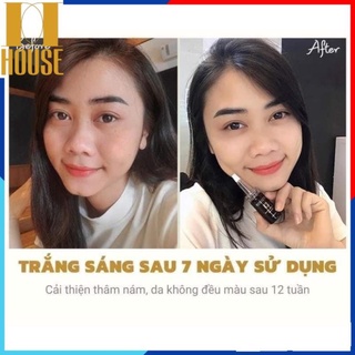 SET TINH CHẤT TẾ BÀO GỐC YOBECELL (5 CHAI)