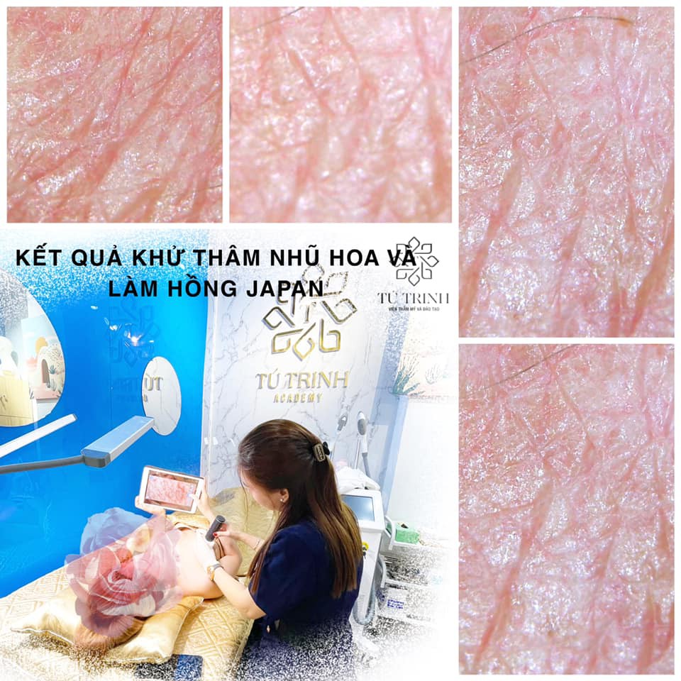 Kem làm hồng nhũ hoa - vùng kín Nature | BigBuy360 - bigbuy360.vn