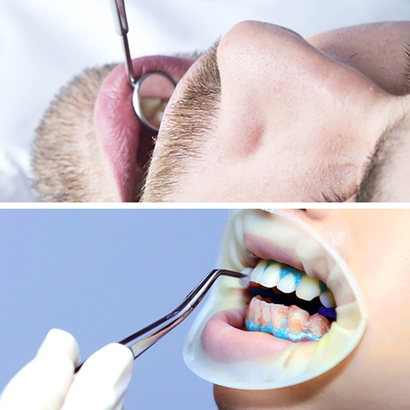 Bộ dụng cụ vệ sinh răng miệng hỗ trợ lấy cao răng và mảng bám