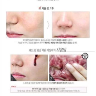 Tinh Chất Peel da RED PEEL TINGLE SERUM
