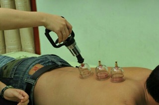 Giác hơi không dùng lửa Duy Thành