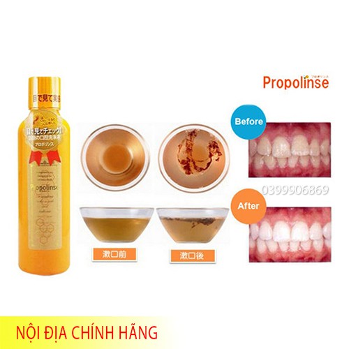 Nước Súc Miệng PROPOLINSE Màu Cam Nội Địa Nhật Bản