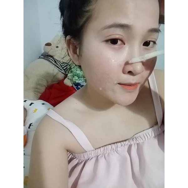 Combo kem fece & trắng da