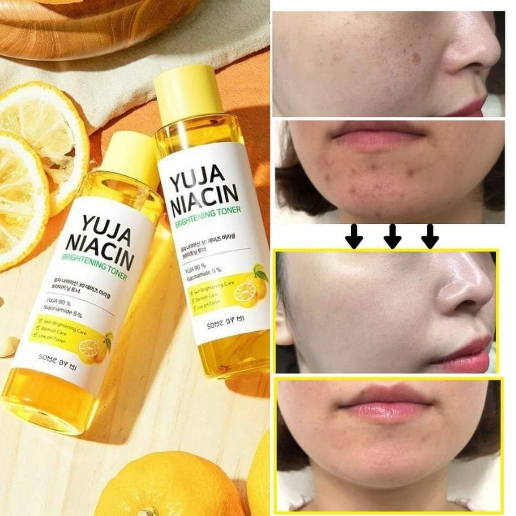 Nước hoa hồng dưỡng trắng giảm thâm Some by mi YUJA NIACIN Toner