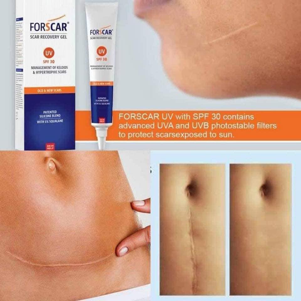 {Hàng Nhập} Gel mờ Sẹo Forscar Scar Recovery Gel 10g giúp giảm vết thâm, sẹo lồi, lõm, giúp hồi phục da