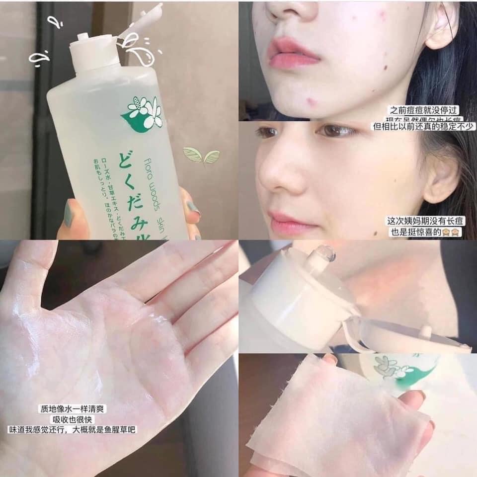 Nước hoa hồng Lotion Toner diếp cá tía tô Dokudami ngăn ngừa mụn 500ml Nhật Bản