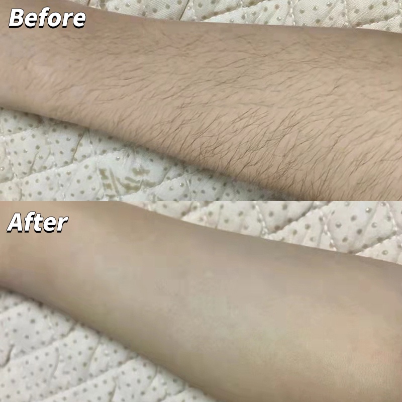 Kem Tẩy Lông Rnw Dịu Nhẹ Không Gây Kích Ứng Cho Vùng Da Dưới Cánh Tay Và Chân Cho Nam Nữ 120g