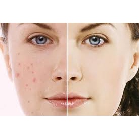 Thiên môn chùm đẹp da, lợi sữa - Himalaya Shatavari