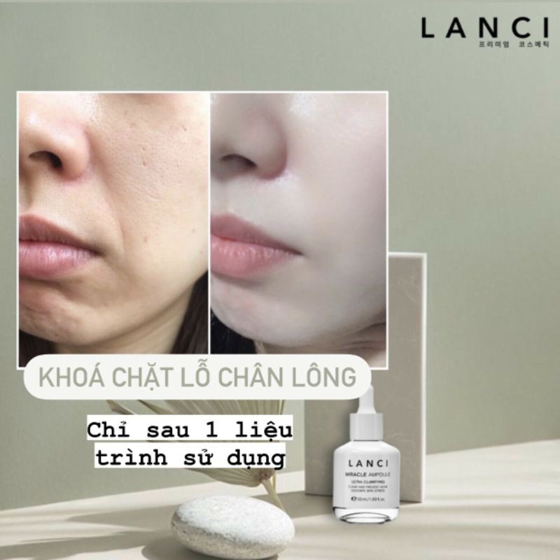 🌿SIÊU SERUM LANCI 🍀 Phục Hồi 🍀 Tái Tạo Da 🍀 MIRACLE AMPOULE ULTRA🌿