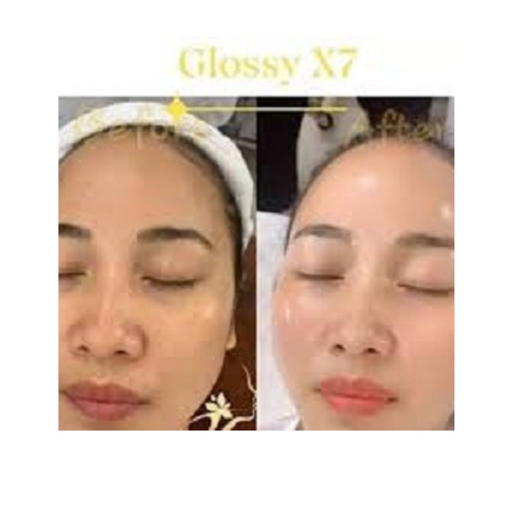 [CHÍNH HÃNG] Bộ Căng Bóng Xóa Nhăn Làm Trắng Glossy Skin White X7 [Cách Làm Trắng Da]
