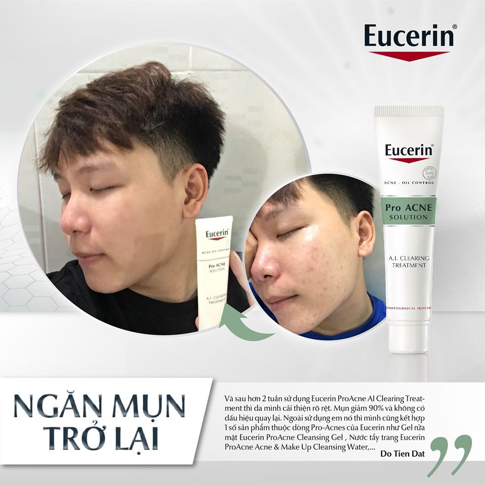 Gel giảm mụn Eucerin Pro acne A.I. clearing treatment