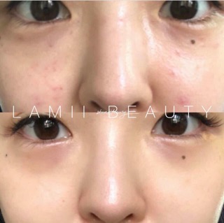 Tinh Chất AMPLEN Peptide Shot Ampoule Coreana