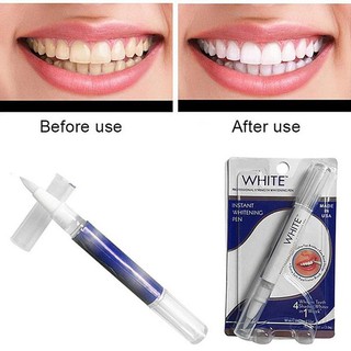 Bút Tẩy Trắng Răng Dazzling White