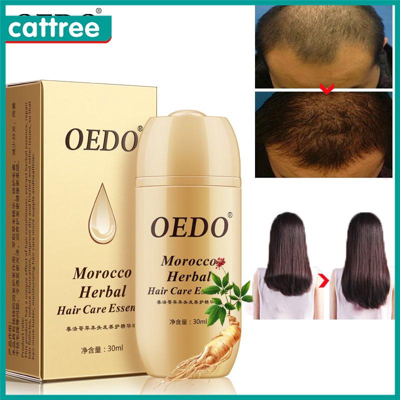 [Hàng mới về] Tinh chất mọc tóc OEDO 30ml