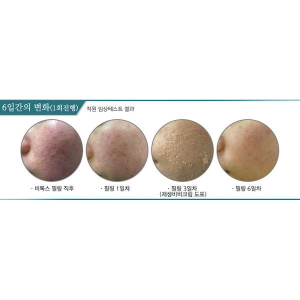 Thay da sinh học Matrigen B-TOX PEEL Hàn Quốc – 2 màu cho spa | BigBuy360 - bigbuy360.vn