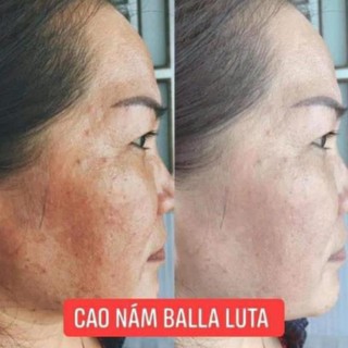 [Free Ship] _ Combo Cao Nám Balla Tula