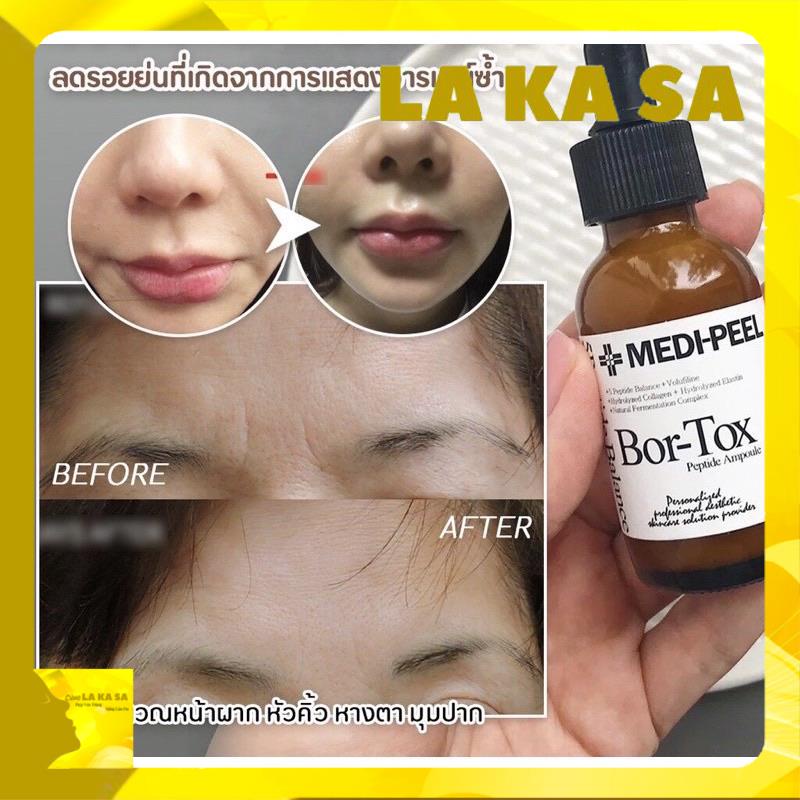 Bortox Medi Peel Căng Bóng, Chống lão Hoá
