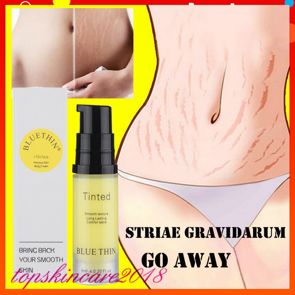 Kem hỗ trợ giảm rạn nuôi dưỡng và phục hồi da hư tổn