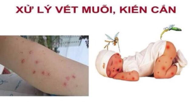 DUNG DỊCH VỆ SINH ĐA NĂNG GYNO PRO - Sản phẩm của đề án 818 Tổng cục dân số