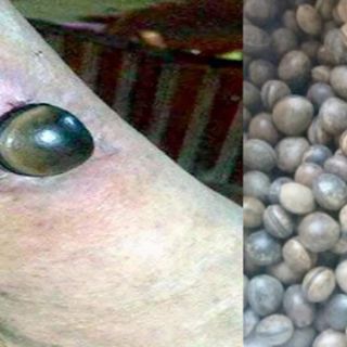 COMBO 10 HẠT ĐẬU LÀO ( HẠT HÚT ĐỘC )