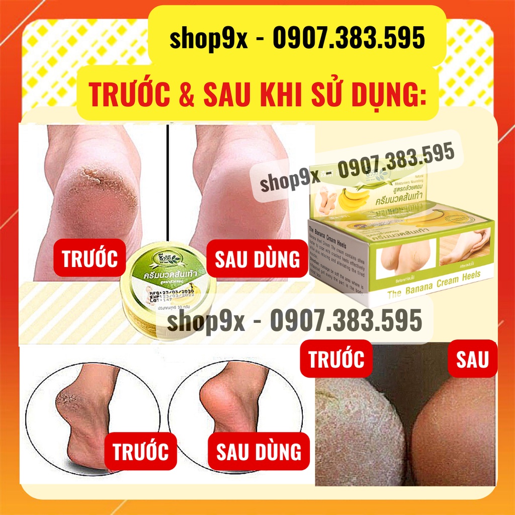 Kem Nứt Gót Chân Giảm Thâm Dưỡng Ẩm BANANA HEEL CREAM 30g Thái Lan