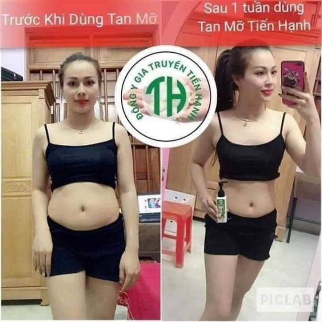 Kem tan mỡ bụng sau sinh Tiến Hạnh_tặng đai nịt bụng và thước đo