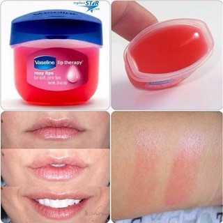 SON DƯỠNG MÔI VASELINE LIP THERAPY ORIGINAL 7G