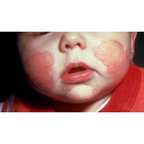 KEM DEXERYL PHÁP MẪU MỚI GLYCEROL DÙNG CHO CẢ GIA ĐÌNH 50g Và 250g