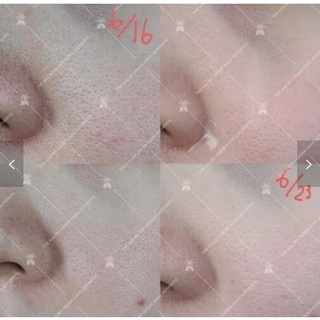 SERUM NIA 20