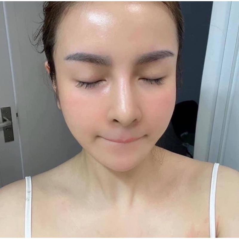 Siêu căng bóng trẻ hoá tái tạo da  treatment da nám RETINOL mỹ