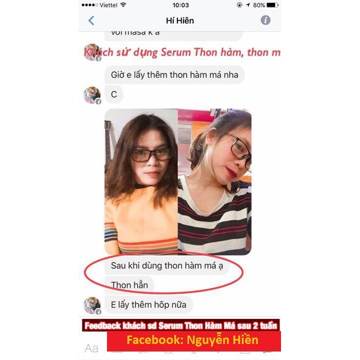 Tinh Chất Thon Gọn Mặt V-line Pháp