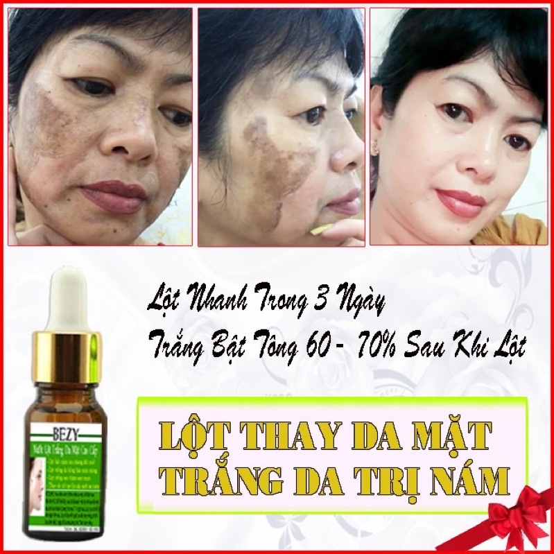 Tái Tạo Lột Thay Da Trắng Hết Nám Bezy
