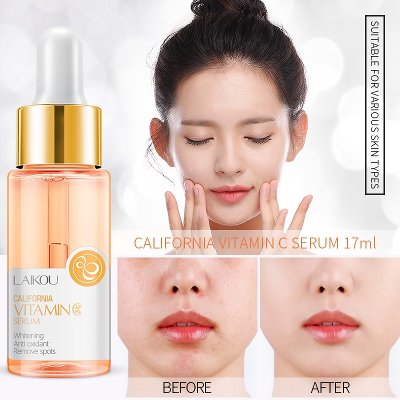 Serum và kem dưỡng LAIKOU với tinh chất vitamin C dưỡng trắng sáng da loại bỏ tàn nhang thâm quầng đốm đen sạm