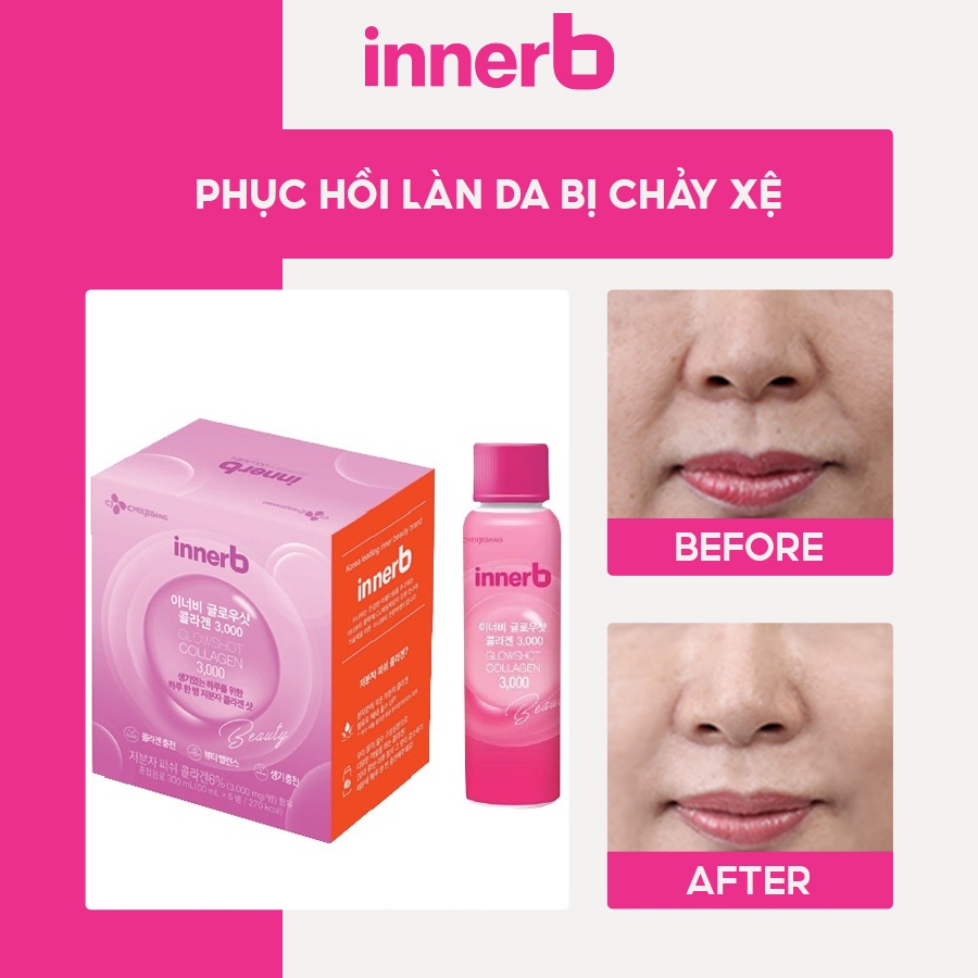 Hộp 6 Chai Nước Uống Bổ Sung Collagen Innerb Glowshot Collagen 50mlx6