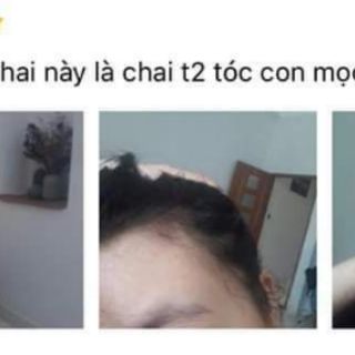 Serum siêu mọc tóc MAHAAD - Thái lan